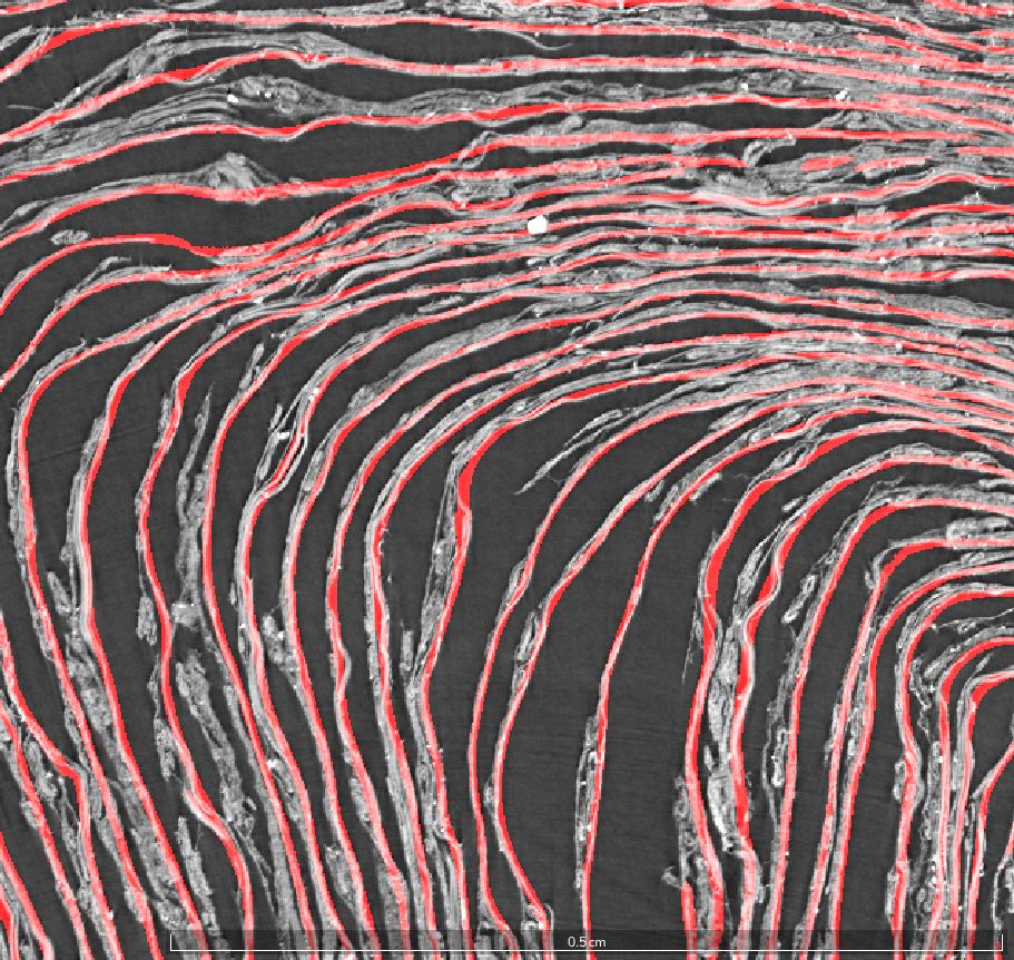 Recto-surface prediction overlaid in red on a CT cross-section